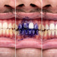 Blanqueador Dental Blanquísimo v34