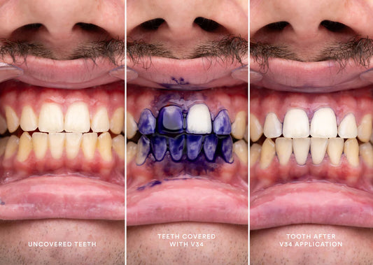 Blanqueador Dental Blanquísimo v34